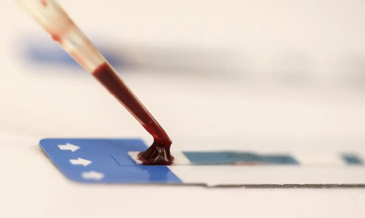Fiocruz lança estudo inédito para ampliar prevenção do HIV entre jovens periféricos