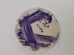 Descoberta de nova toxina em bactérias pode revolucionar tratamentos antimicrobianos