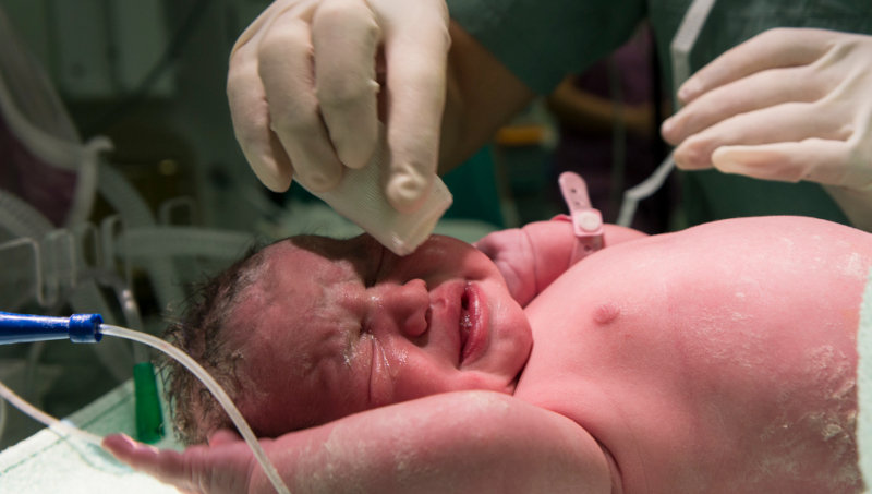 IA revoluciona avaliação da dor em bebês na UTI neonatal