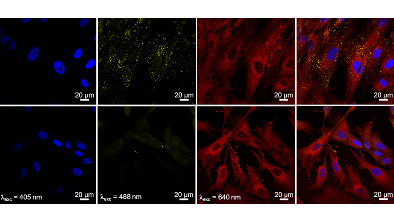Nanopartículas de hidroxiapatita avançam em imagem médica e câncer