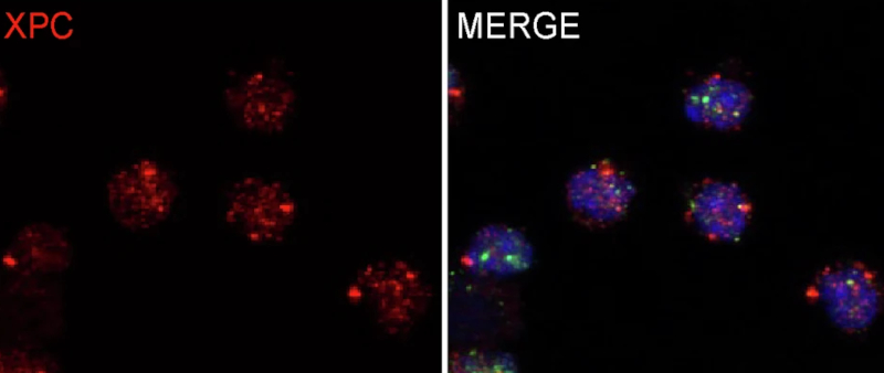 Proteína XPC é essencial para defesa imunológica e reparo do DNA em linfócitos T