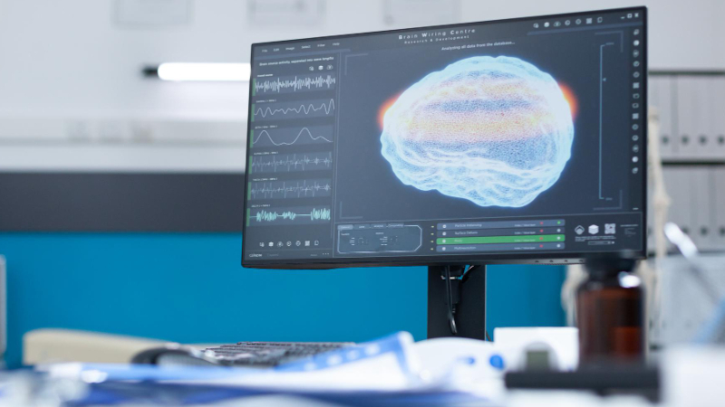 Estudo inova na reabilitação pós-AVC com neuromodulação e fisioterapia