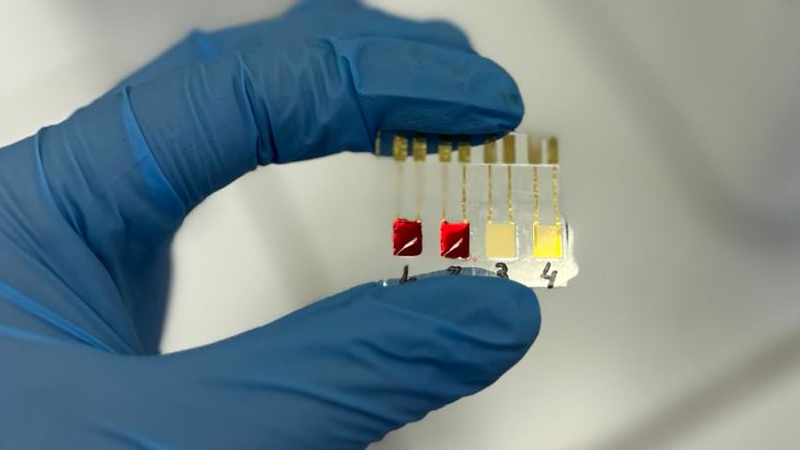 Biossensor inovador detecta câncer de pâncreas em estágio inicial com rapidez