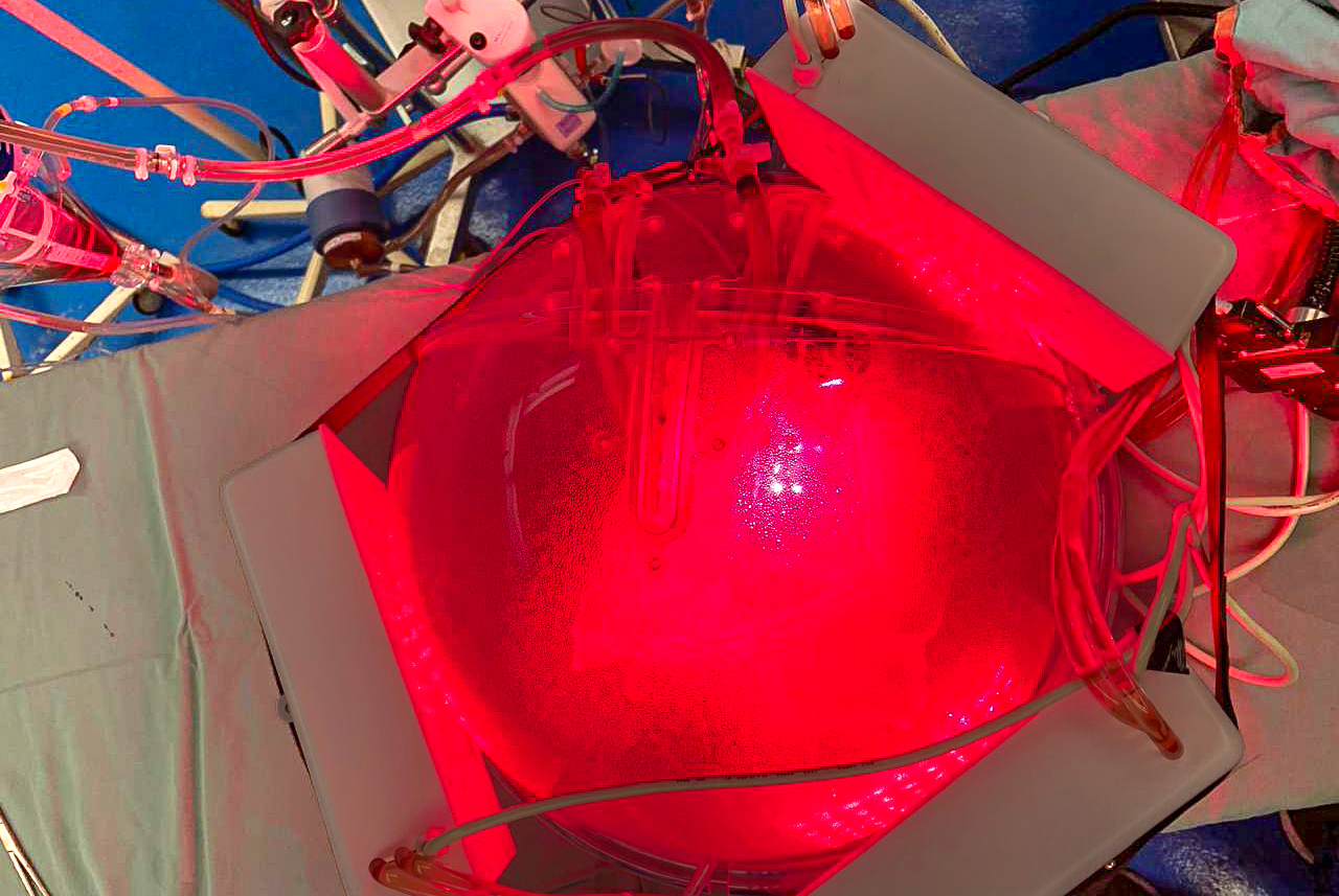 ‘Gêmeo digital’ do tórax simula aplicação de luz para tratamento de pneumonias