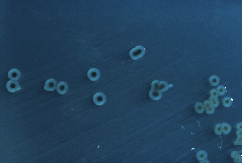 Estudo da USP identifica 45 novas toxinas de Salmonella em infecções alimentares