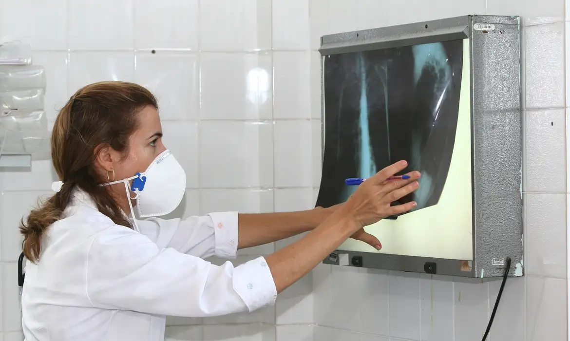 OMS destaca testes rápidos para acelerar diagnóstico da tuberculose