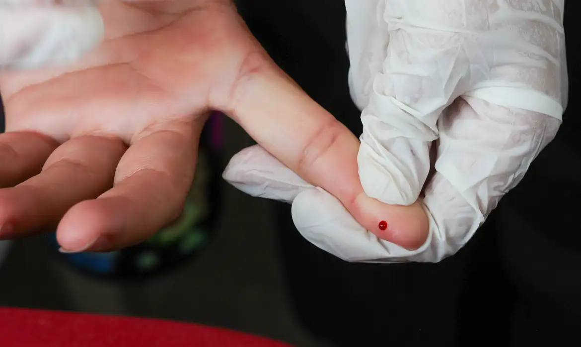 SUS inicia teste rápido para diagnóstico precoce da dengue