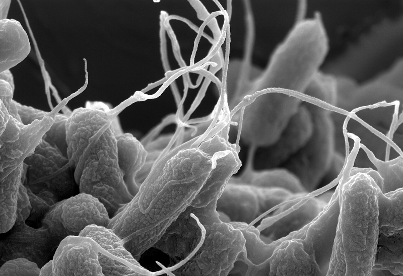 FAPESP e parceiros lançam edital para combater resistência antimicrobiana na América do Sul